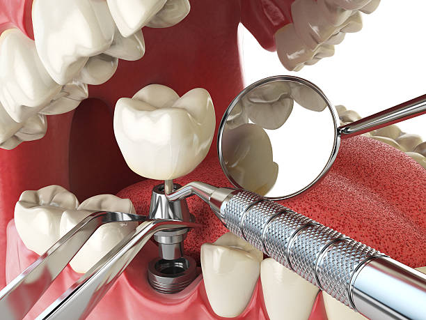 Best Emergency Broken Tooth Repair in Edgeworth, PA